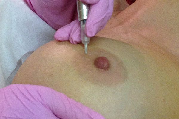Areola Tattoo Mandurah