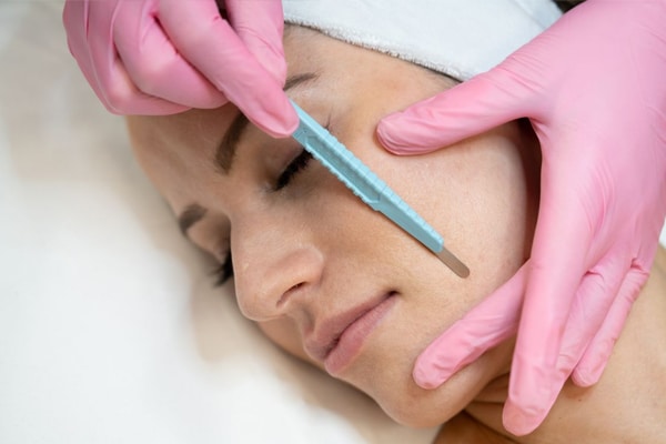 dermaplaning treatment for scarring