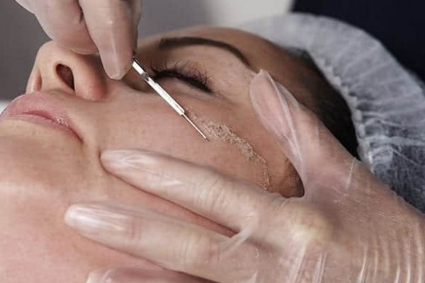remove fine wrinkles with dermaplaning