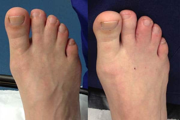 cosmetic webbed toe tattoo